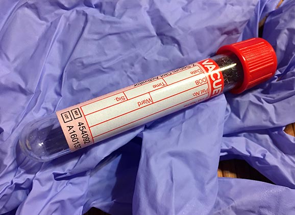 adult_diagnostic_indication_img03